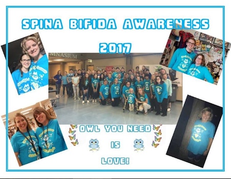 Adelaide's Brigade Spina Bifida Awareness 2017 T-Shirt Photo